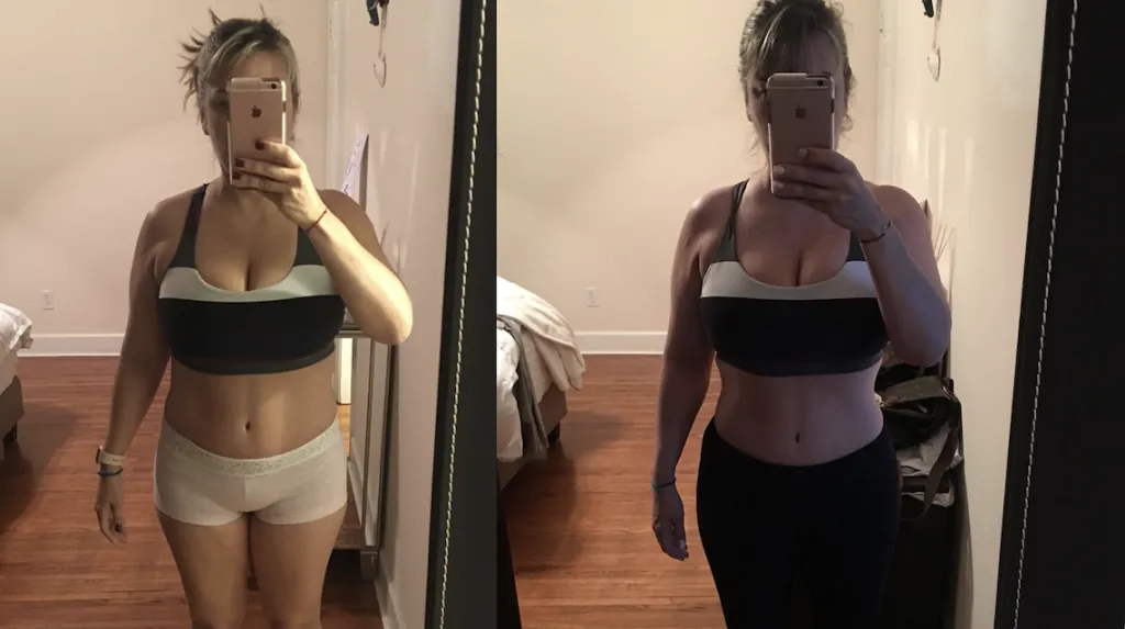 Before and after: Medical Weight Loss — 6 Month Result at Rewind Anti-Aging of Miami