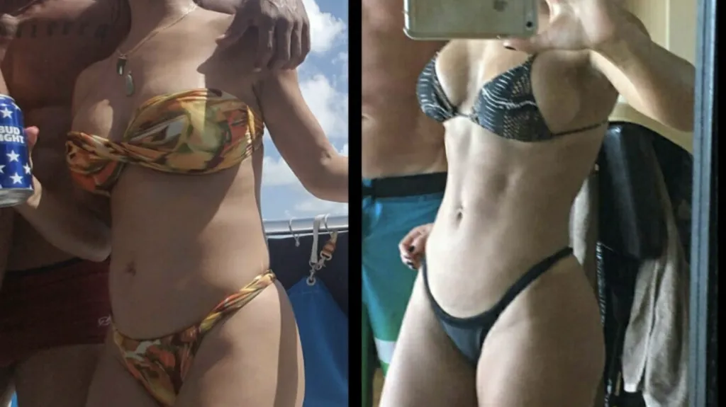 Before and after: Weight Loss & Recovery Protocol at Rewind Anti-Aging of Miami