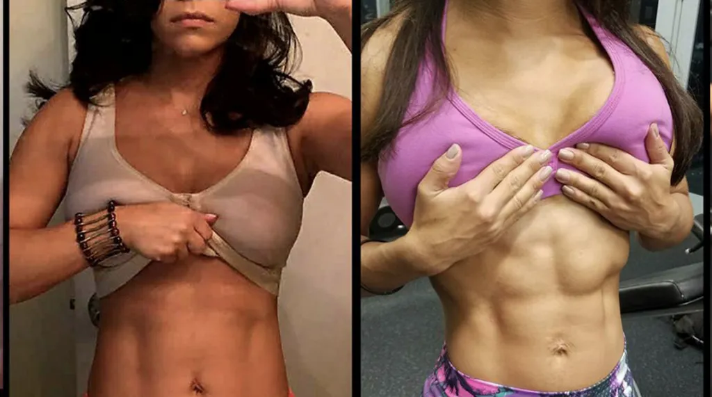 Before and after: Hormone Balancing & Transformation at Rewind Anti-Aging of Miami