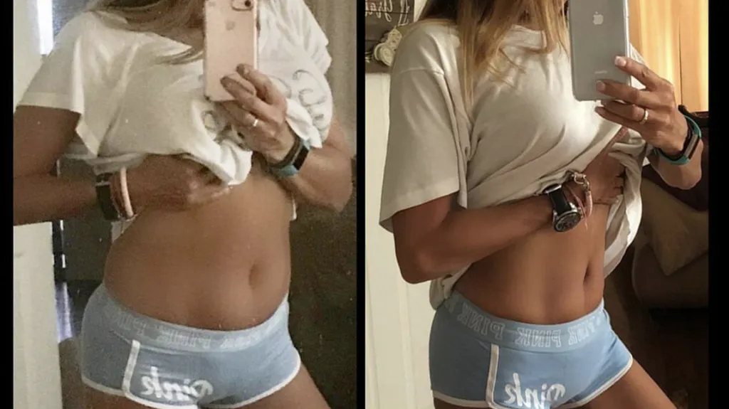 Before and after: Medical Weight Loss — Sustained Results at Rewind Anti-Aging of Miami