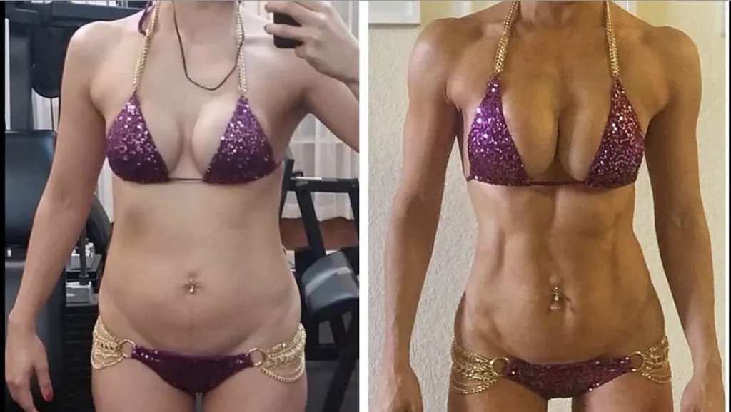 Before and after: Comprehensive Wellness Transformation at Rewind Anti-Aging of Miami