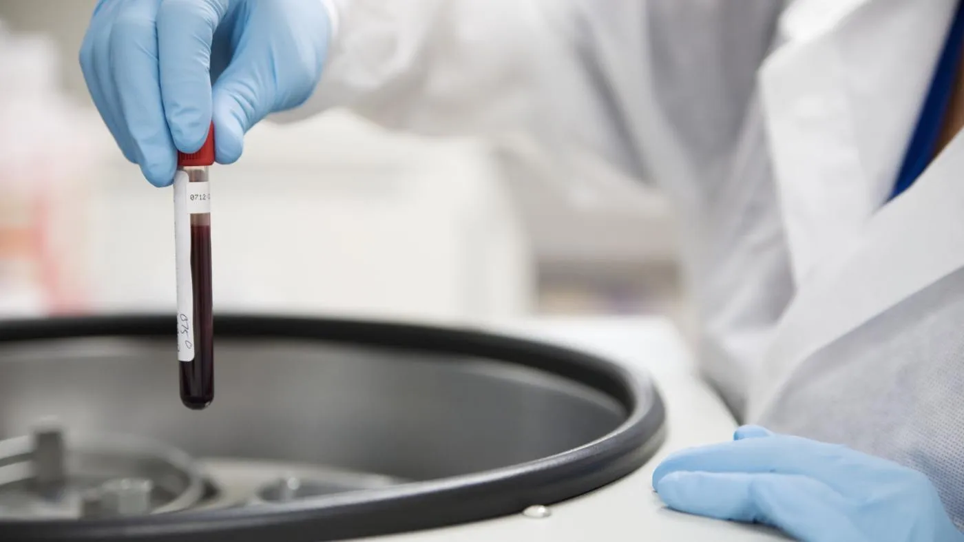 Diagnostic testing equipment used alongside full-body MRI screening at Rewind Anti-Aging Miami