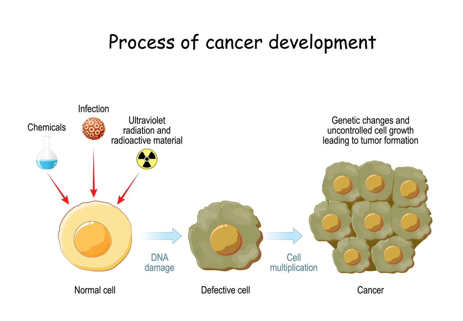 Cancer cell development diagram showing how cancers grow and why early detection with Galleri is critical