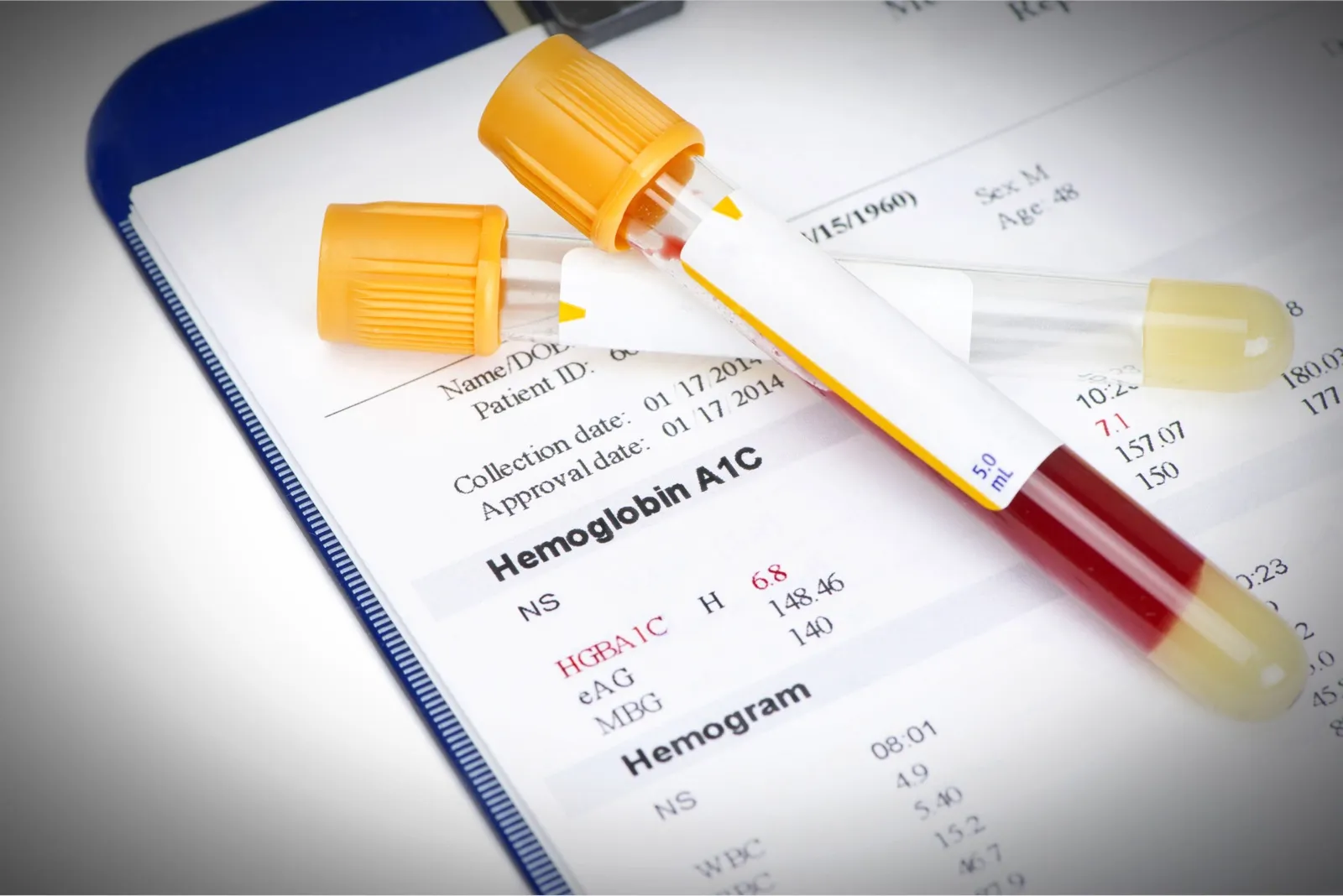 Detailed executive lab panel results showing hemoglobin and biomarker analysis at Rewind Anti-Aging Miami