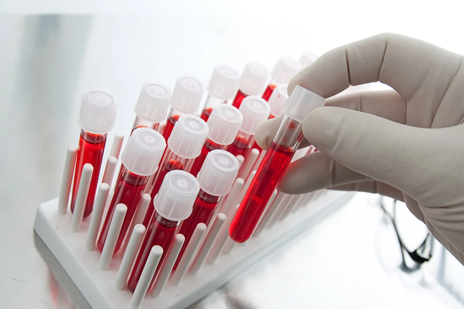 Lab technician processing comprehensive executive blood panel at Rewind Anti-Aging Miami
